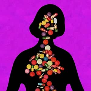 TV GIRL - FAUXLLENIUM[VINYL]